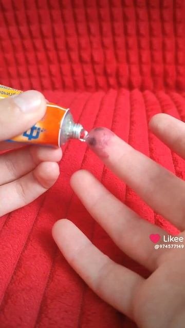 укусил Томпсон. Что делать?