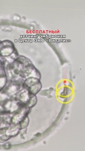 Бесплатный вспомогательный хетчинг эмбрионам в Центре ЭКО «Виталис»