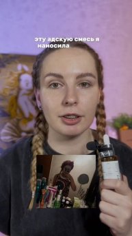 Мой уход от прыщей на WB #419866236 🫰🏻