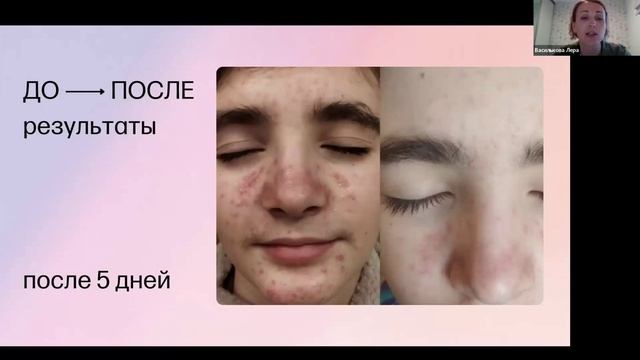 Про здоровье результаты #онкозаболеваний #интегративнаяонкология ,#здоровоепитание