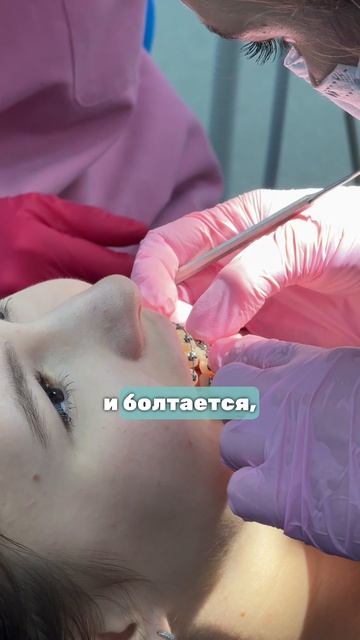 Что делать если отклеился брекет?