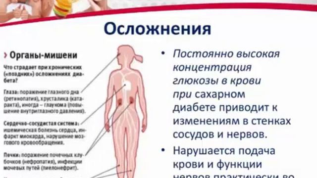 Доктор Галина Костина | Сахарный диабет | Что делать?
