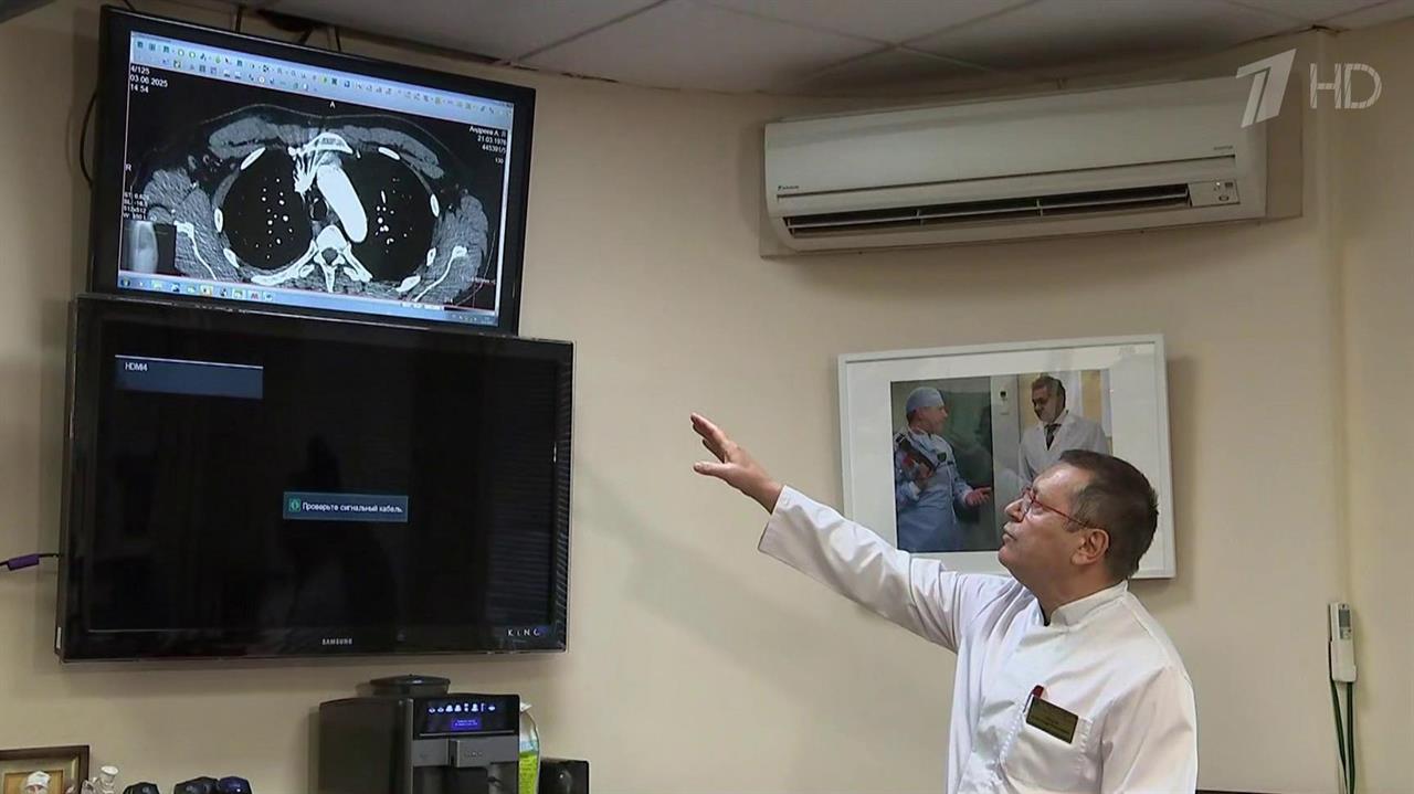 Хирурги военного госпиталя им. А.А.Вишневского извлекли осколок снаряда из сердца военнослужащего