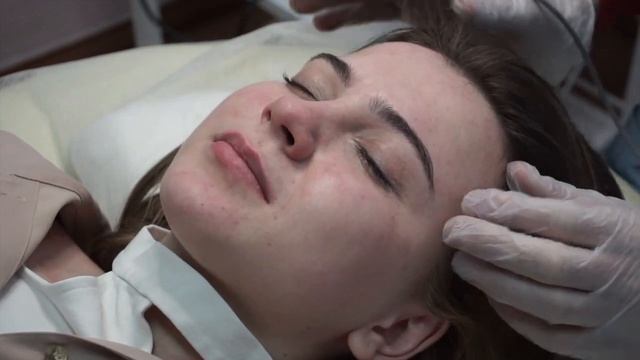 Удаляем Ангиому и Родинки На Носу
