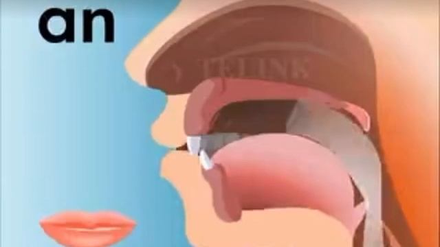 an