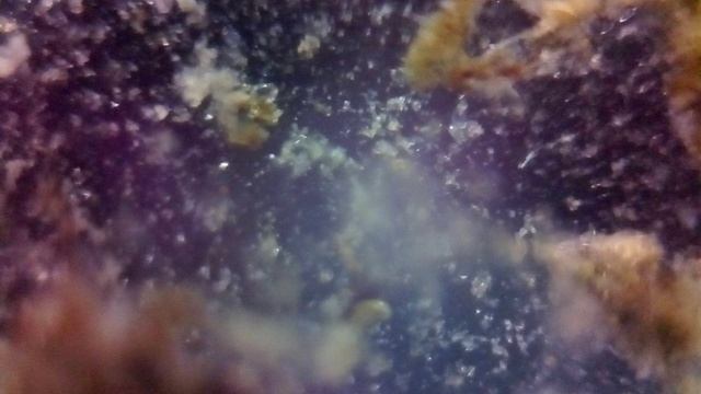 Микромир микроорганизмов в капле воды. Удивительная природа.