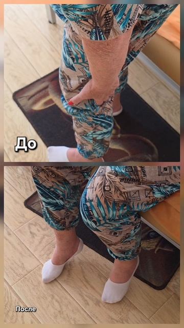 Не гнулось колено 13л и болело.mp4