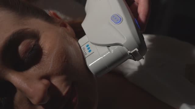 Smas-лифтинг на аппарате Ulthera