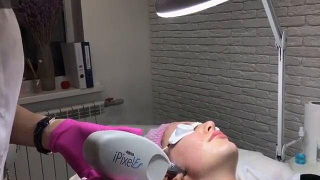 Лазерная шлифовка лица в Ростове-на-Дону | Центр косметологии УРО-ПРО