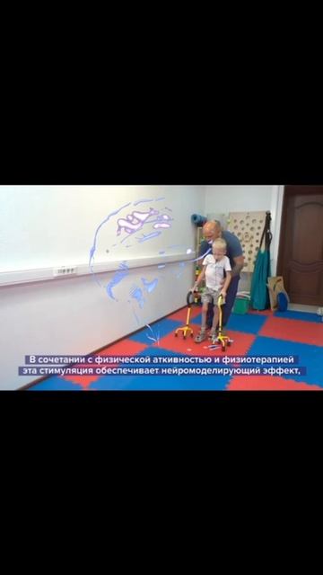 Ролик об ЛВТНС (лингвальной вибротактильной нейростимуляции)