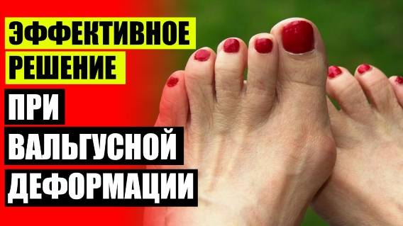 👣 БОЛИТ КОСТОЧКА НА НОГЕ МЕЖДУ ПЯТКОЙ И БОЛЬШИМ ПАЛЬЦЕМ 💣 ЧЕМ МАЗАТЬ ШИШКУ НА НОГЕ ☑