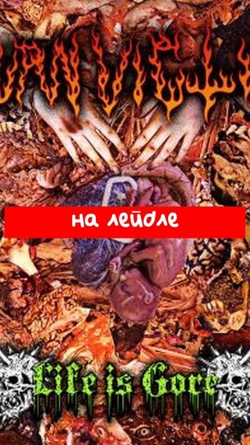 Burn_Victim_—_Life_Is_Gore_(2025)