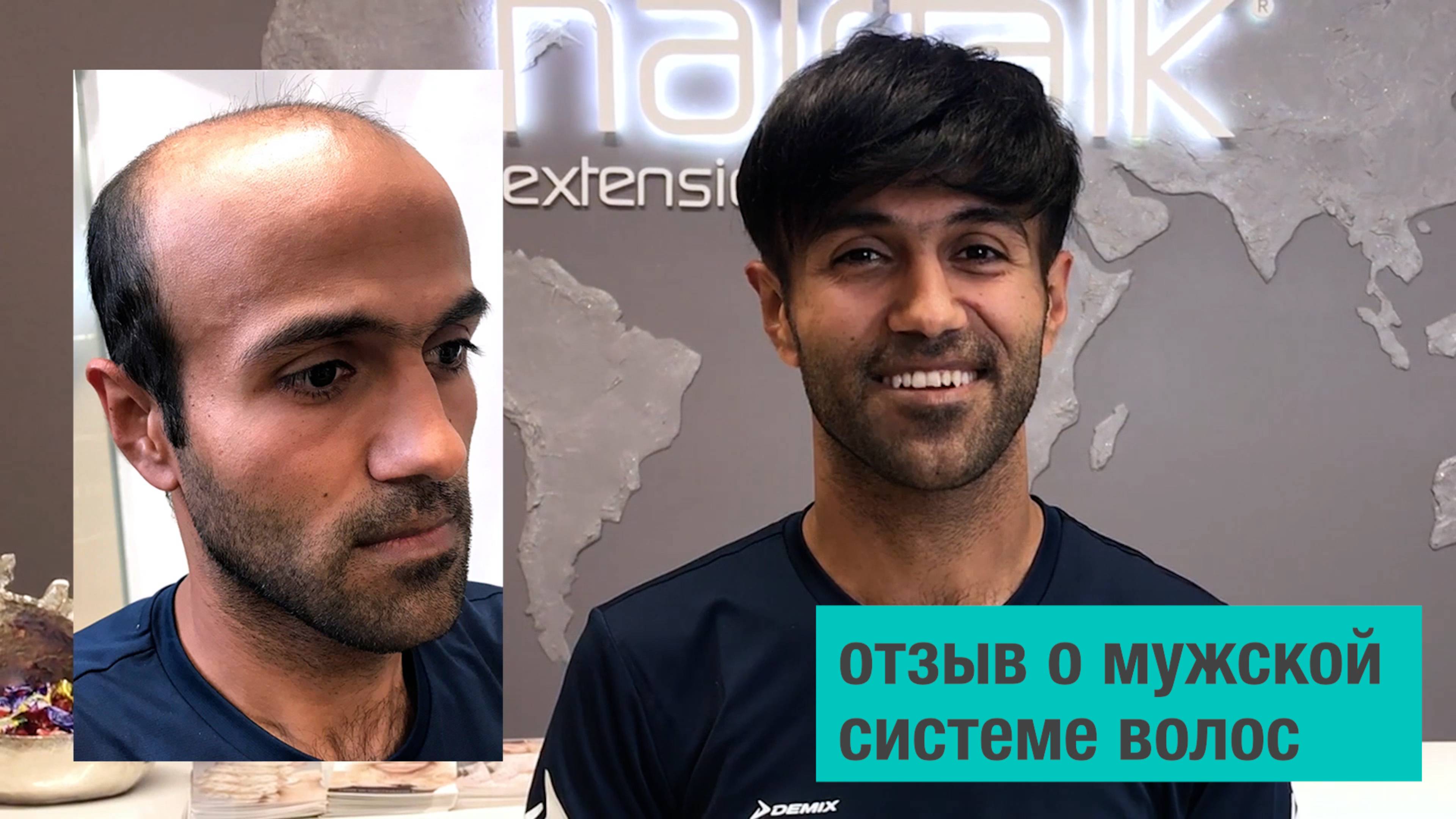 Отзыв мужчины о мужской системе волос Мега Топ