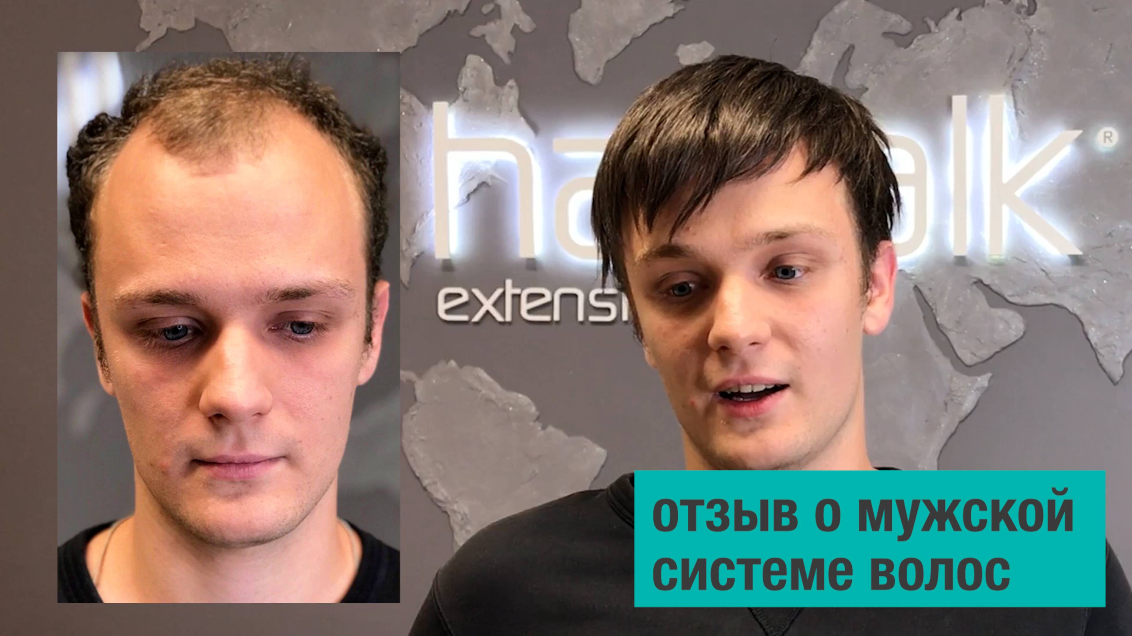 Отзыв парня 26 лет об умной системе волос