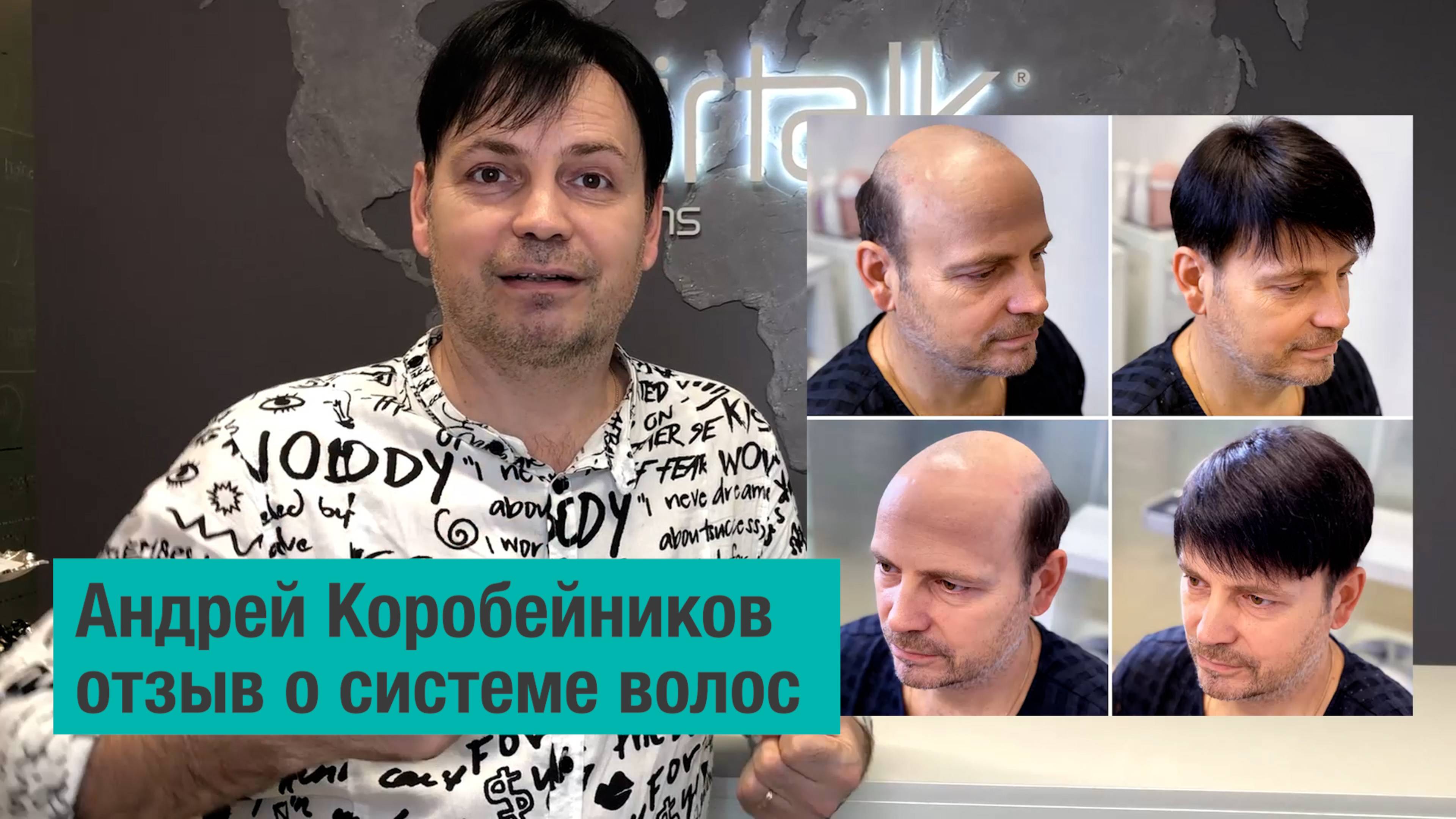 Отзыв мужчины через 6 месяцев использования системы волос