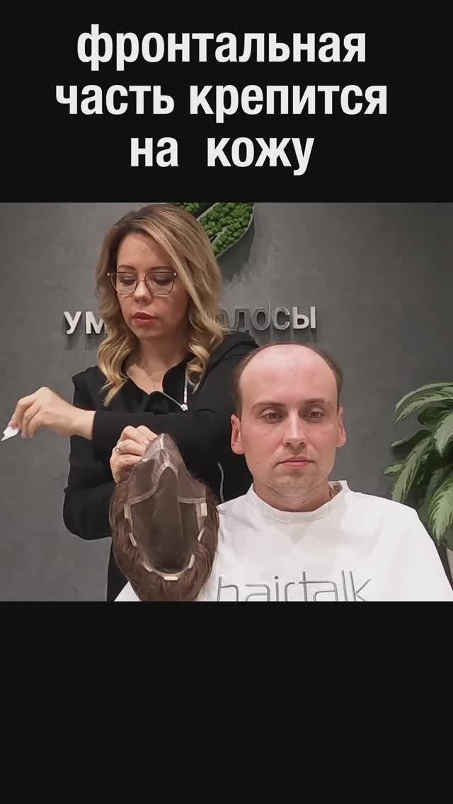 до 40% мужчин к 40 годам имеют облысение