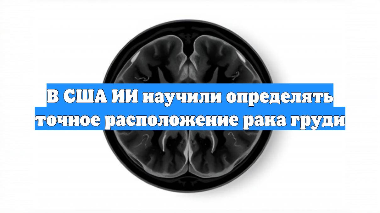 В США ИИ научили определять точное расположение рака груди