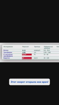 Все дело в железе! Арт WB #313747509 Ozon #1833170870 на #маслорозмарина #отвыпаденияволос
