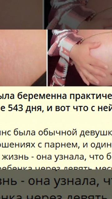 f_740_Девушка была беременна практически два года - целые 543 дня, и вот что с ней стало.._4