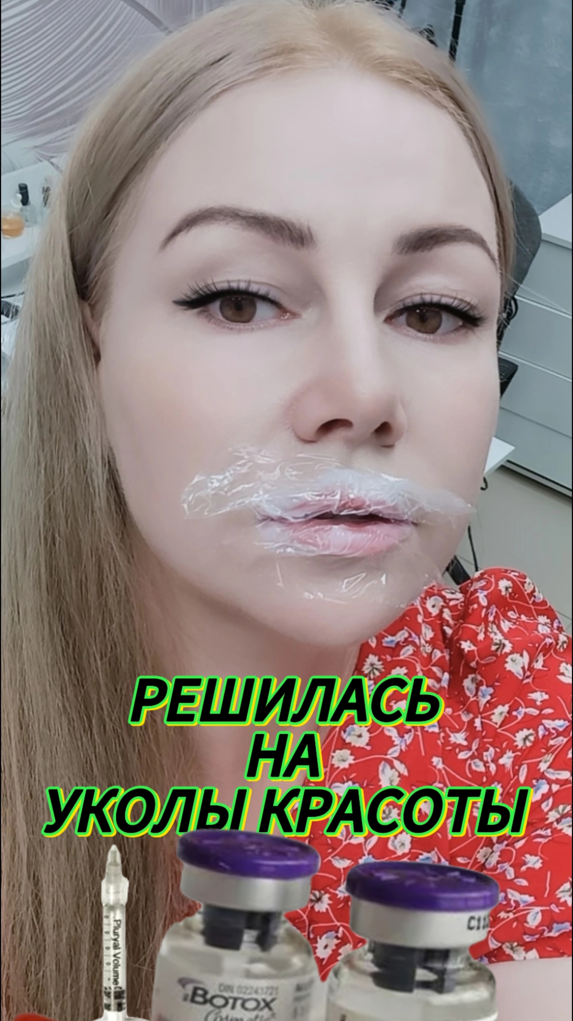 Решилась на ботокс в лоб и филер в губы