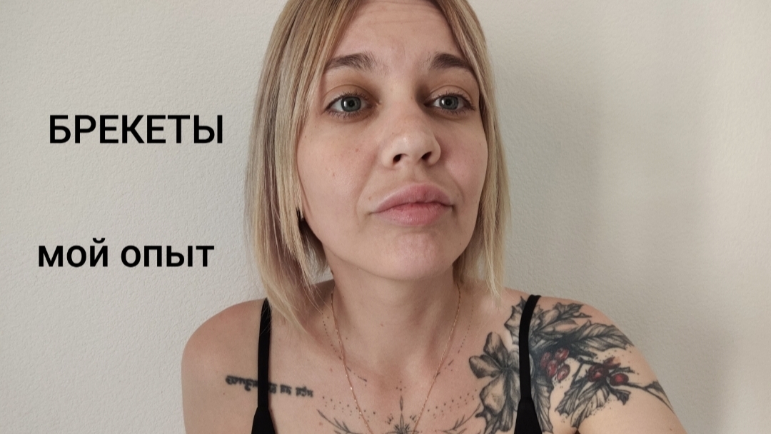 поставила БРЕКЕТЫ / мой опыт