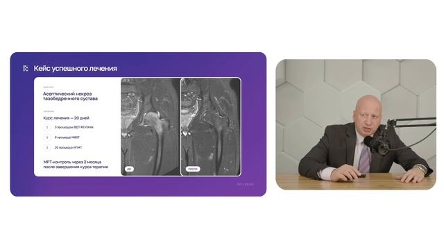 ФДТ REVIXAN в лечении заболеваний суставов, сухожилий и позвоночника