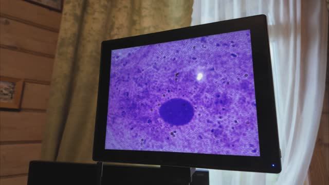 🌿 РЕАЛЬНЫЕ РЕЗУЛЬТАТЫ: КАК АЛЕКСЕЙ ПОБЕДИЛ ПСОРИАЗ И ВОССТАНОВИЛ ЗДОРОВЬЕ