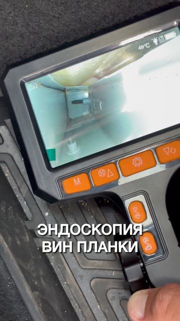 Эндоскопия вин планки Санкт-Петербург
