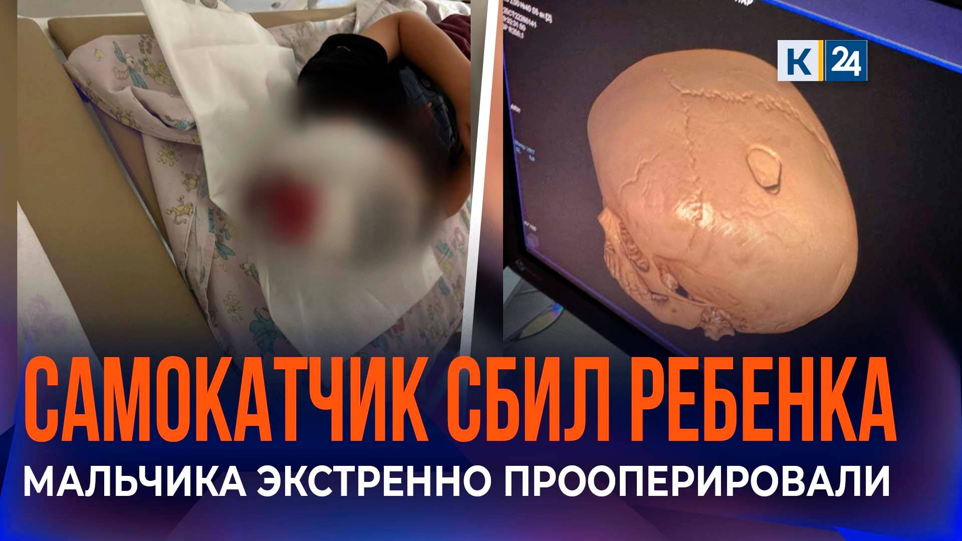 Мать сбитого самокатом 4-летнего мальчика в Краснодаре рассказала о ДТП