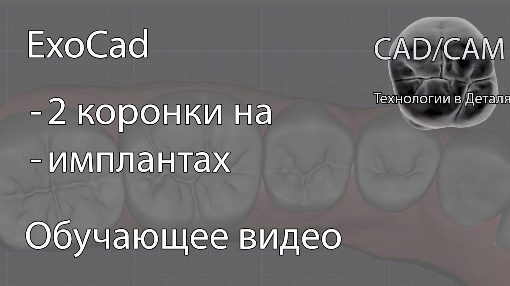 2 зуба на имплантах