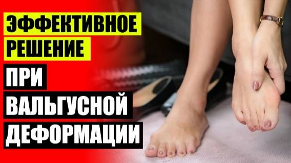 Косточка на внешней стороне стопы что это