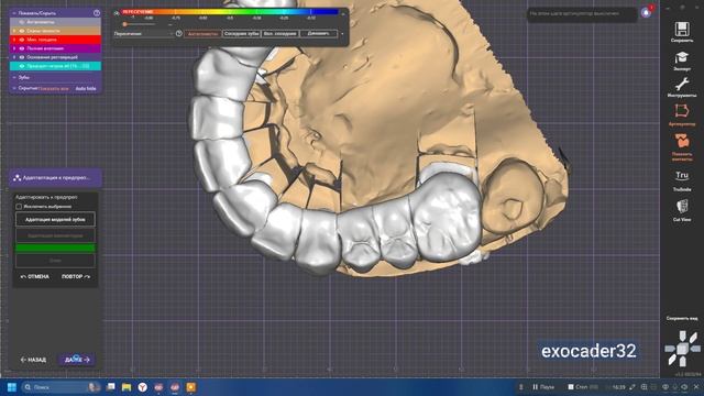 Создание работы по предпрепу без библиотеки зубов