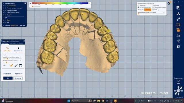 Окклюзия - немного про Artex
