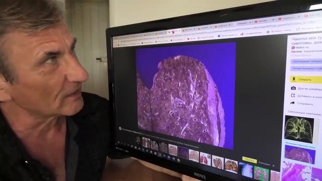 2020. Хочешь чтобы в твоих лёгких была такая красота