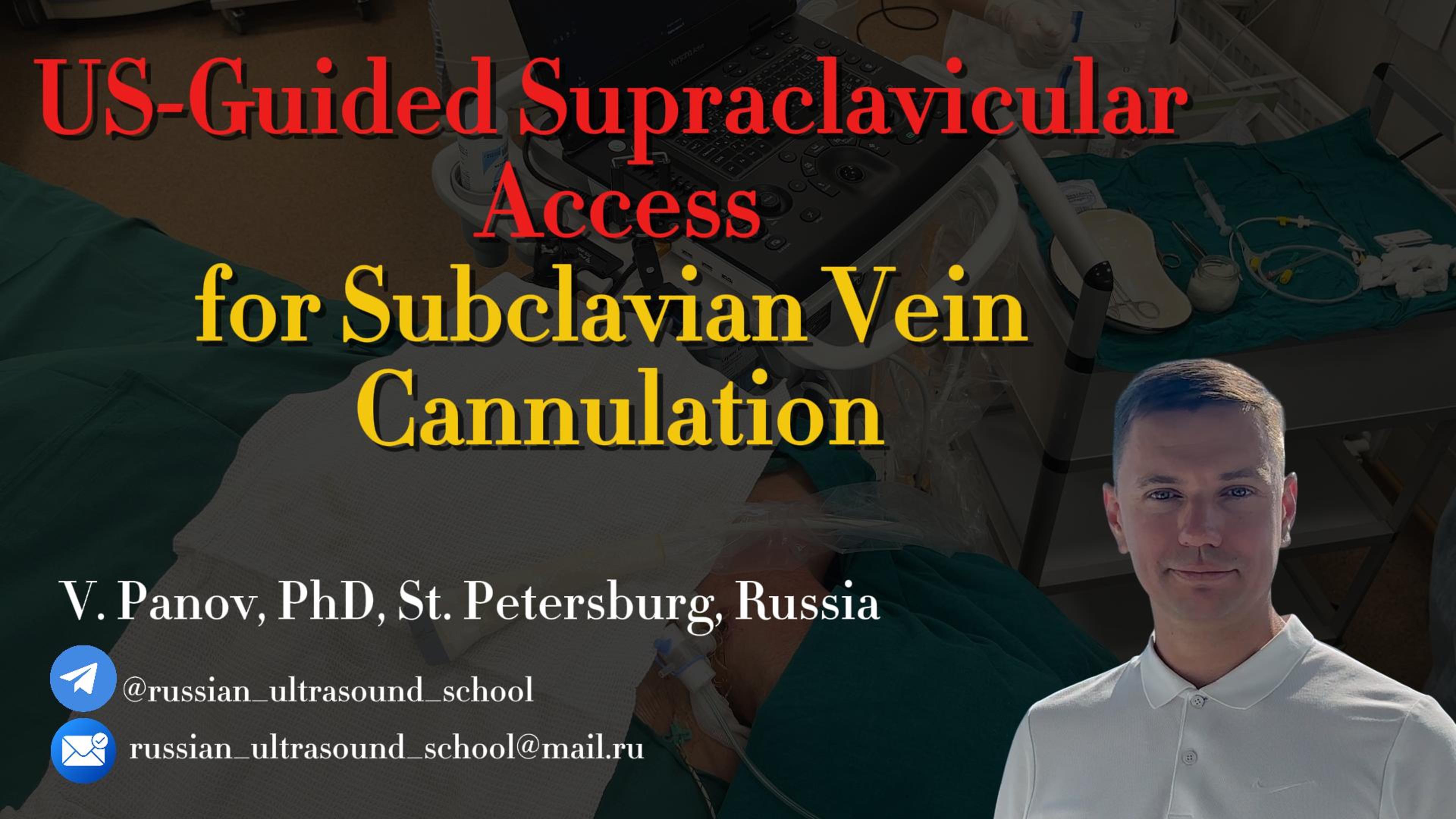 US-GUIDED SUBCLAVIAN VEIN CANNULATION #узи #ultrasound #vascularaccess #cannulation #medicine