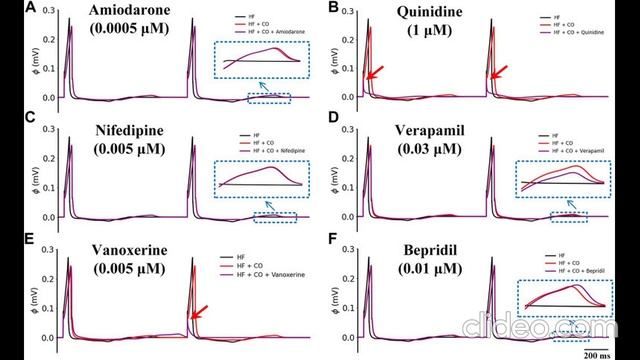 Ранолазин не поможет при отравлении монооксидом углерода (CO, угарный газ)