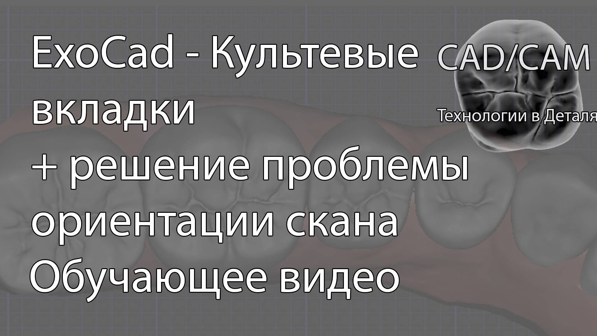 ExoCad - Культевые вкладки + решение проблемы ориентации скана на слепке