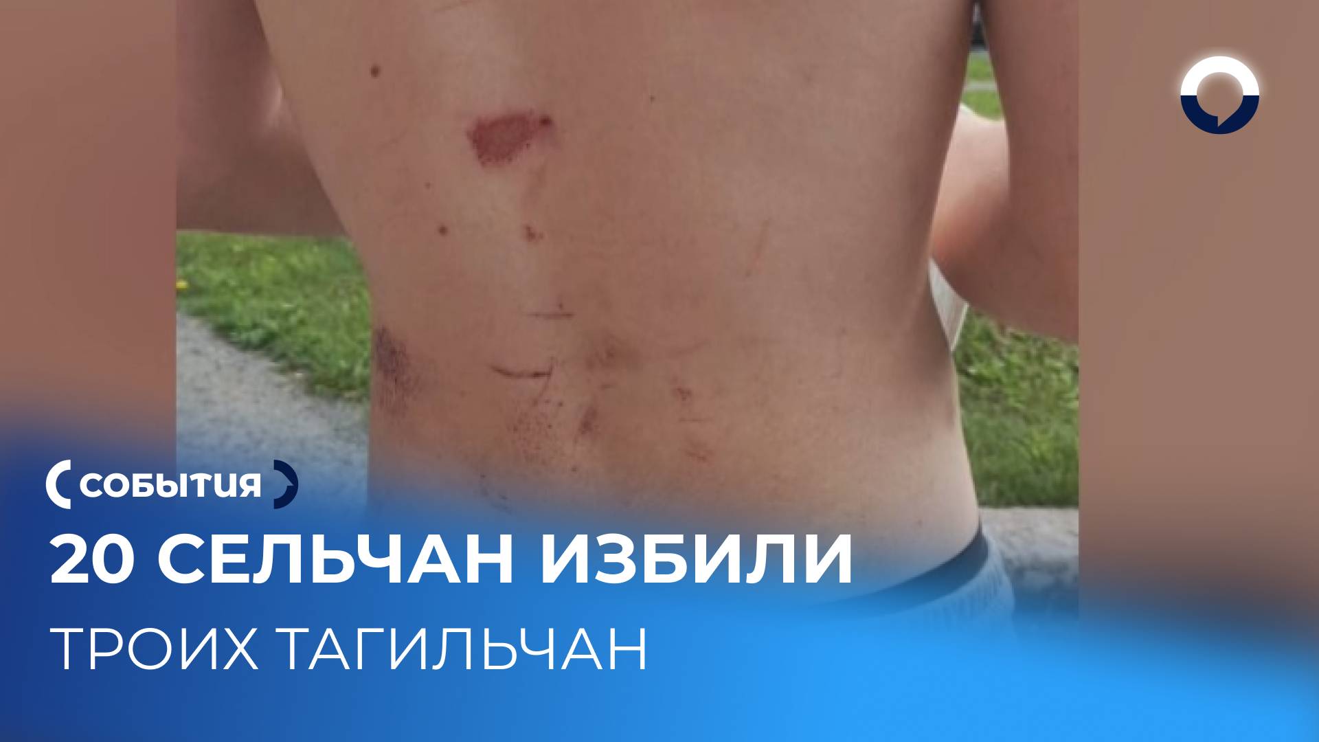 Трое тагильчан оказались в больнице после нападения ночью