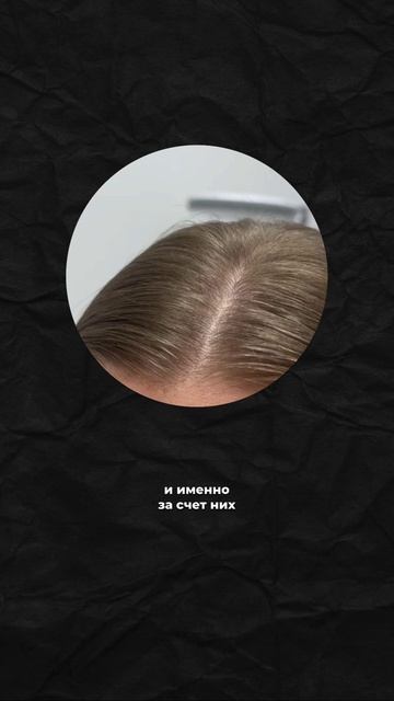 Боишься остаться без волос?