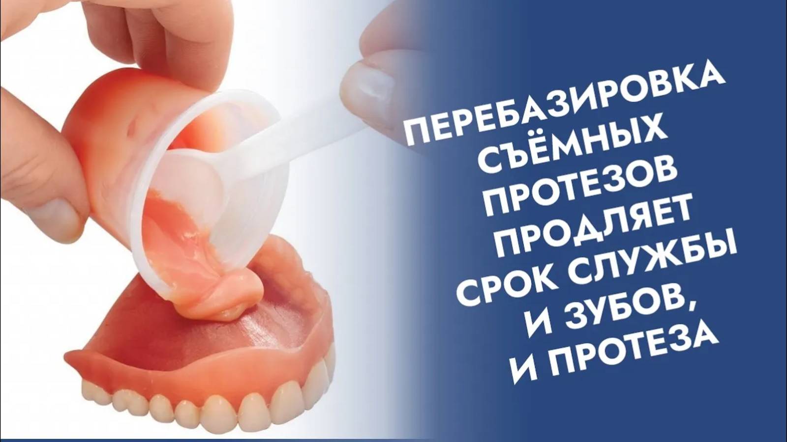 Как комфортно пользоваться съемным протезом?