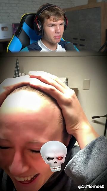 Самый Большой Лоб в Мире! 😮 #shorts #шортс #интересно #эдит #фонк #челлендж #проверка #lisfox