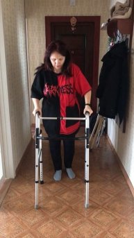 IНа 6 день-дома после эндопротезирования тазобедренного сустава.