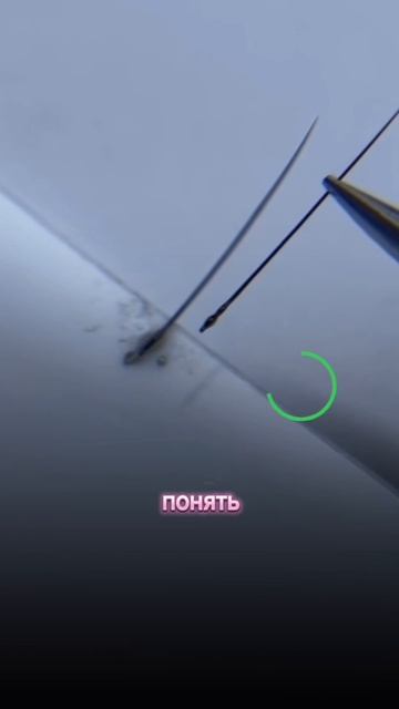 Причина, почему у тебя отслойки!