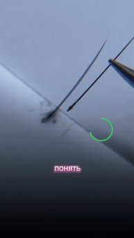 Причина, почему у тебя отслойки!