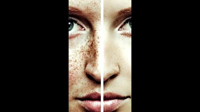 Пигментация. Осветляющая маска. Верните коже сияние!