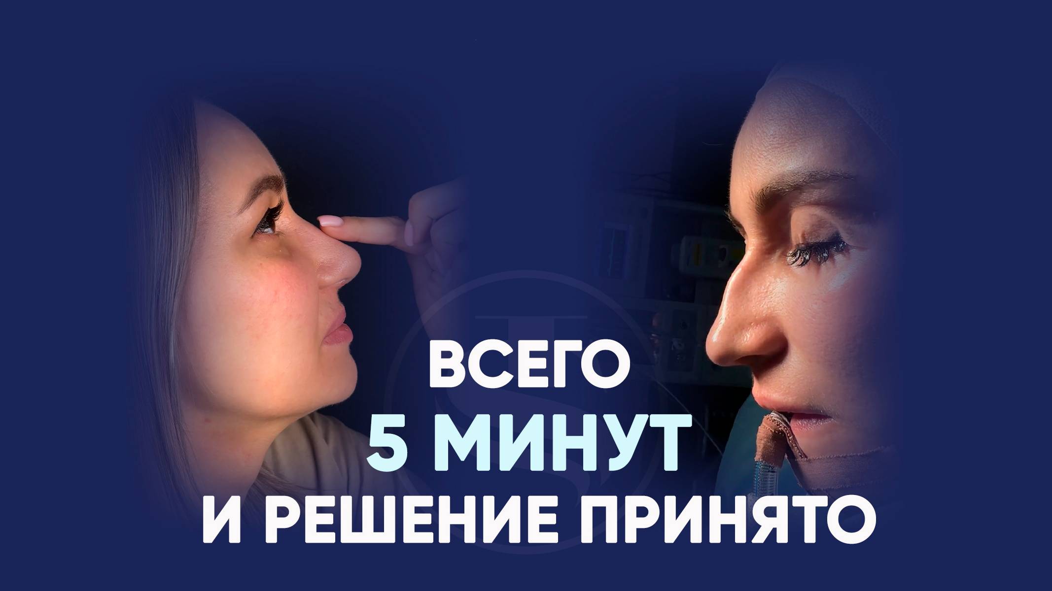 Риносептопластика после травмы: эмоции пациентки и результат