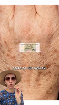 Как убрать пигментные пятна за 100 рублей- мой реальный способ!
