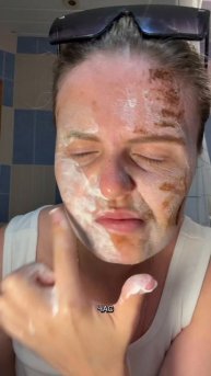 Мой гель от акне от Cosmeya на WB #WW123359 #гель #уход #бьюти #блогер