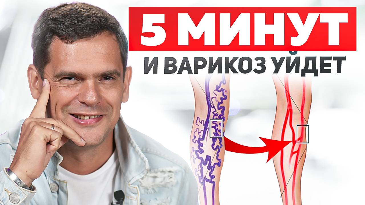 Это действие поможет избавиться от ВАРИКОЗА в ДОМАШНИХ условиях!