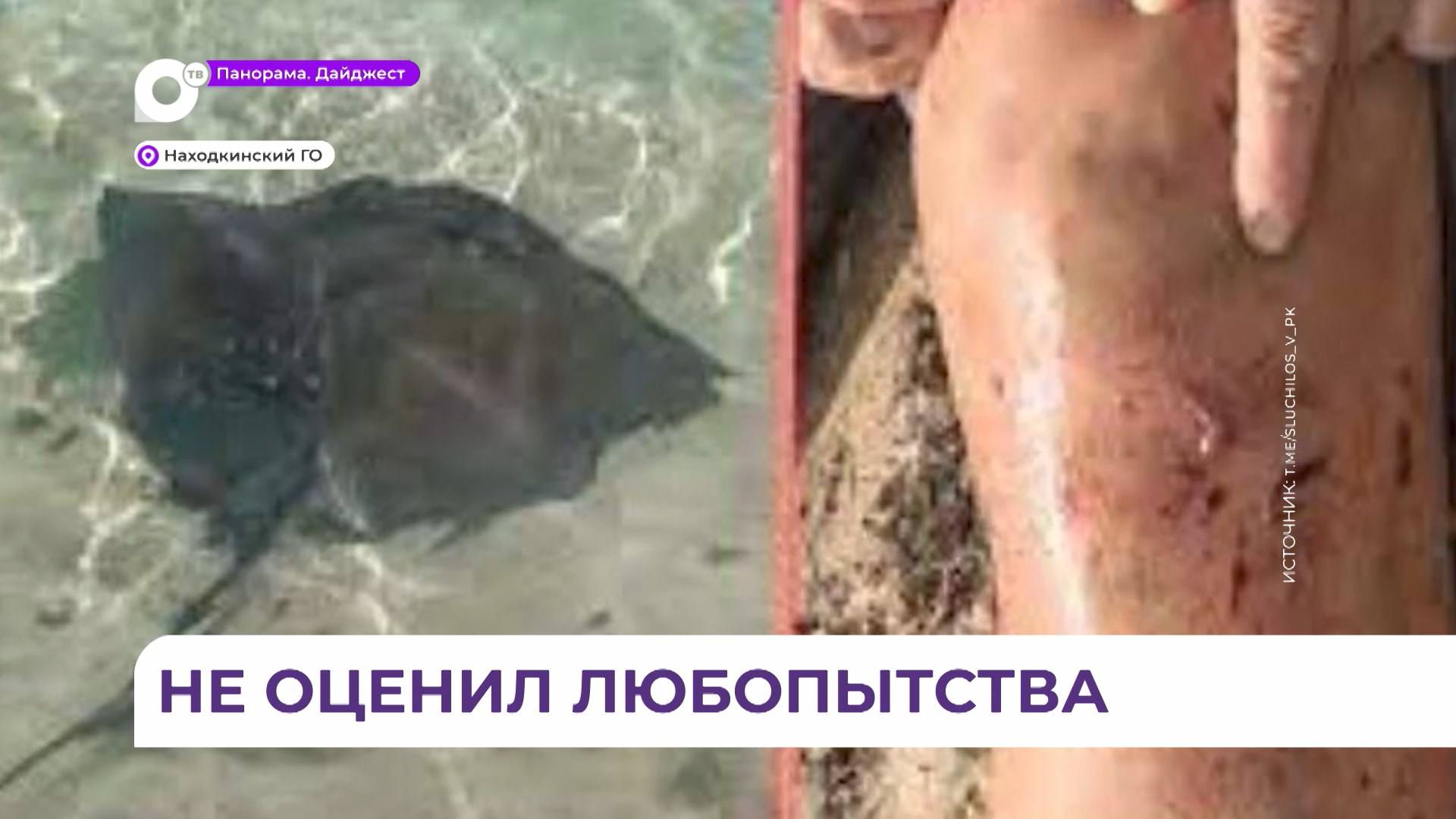 Скат атаковал мужчину недалеко от берега в Находке